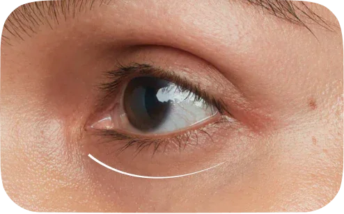 Under-Eye & Dark Lip