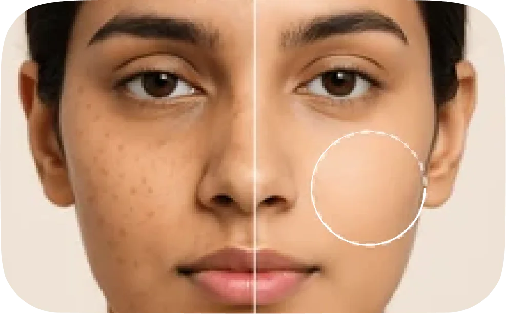 Open Pore & Pigmentation