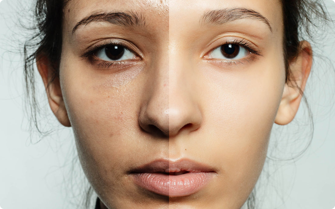 Helps Reduce Pigmentation & Dark Spots