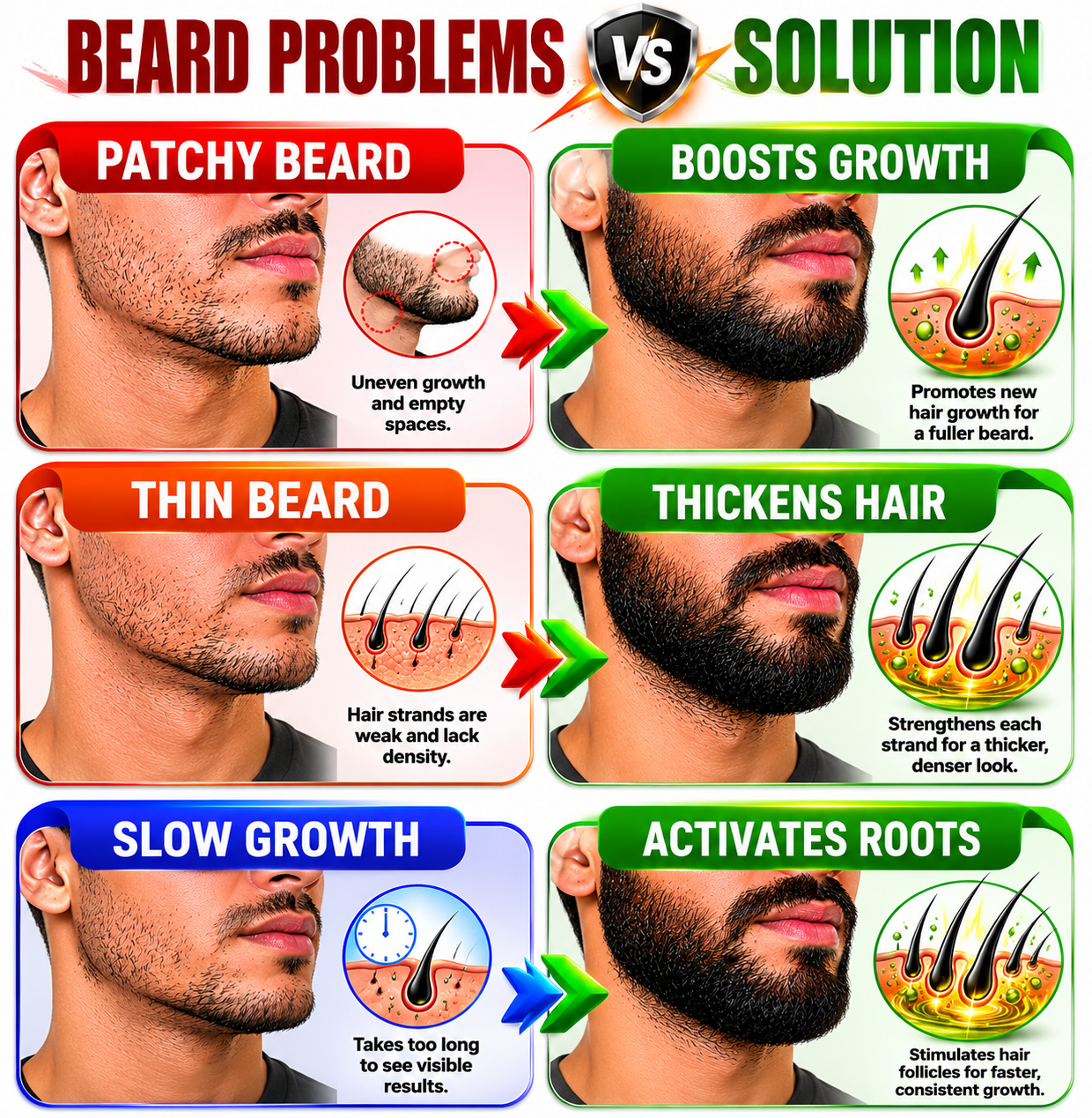 Beard N Sol Rendensyl Beard Growth Serum