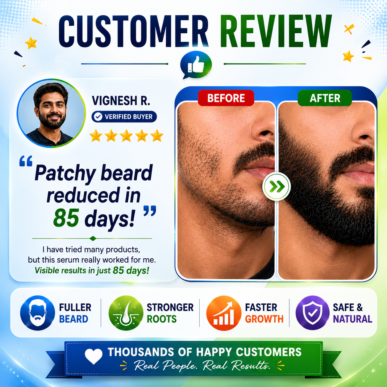 Beard N Sol Rendensyl Beard Growth Serum