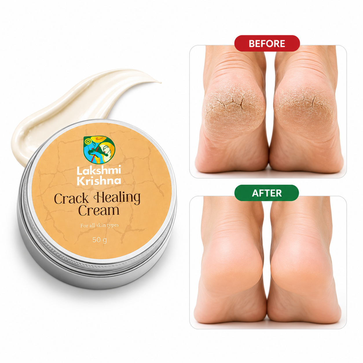 Crack Healing Cream