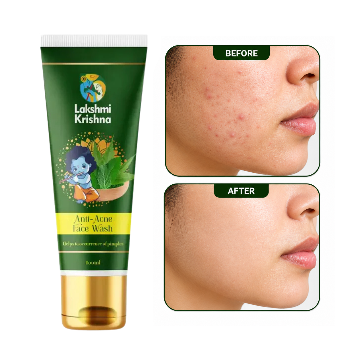 Anti Acne Face Wash
