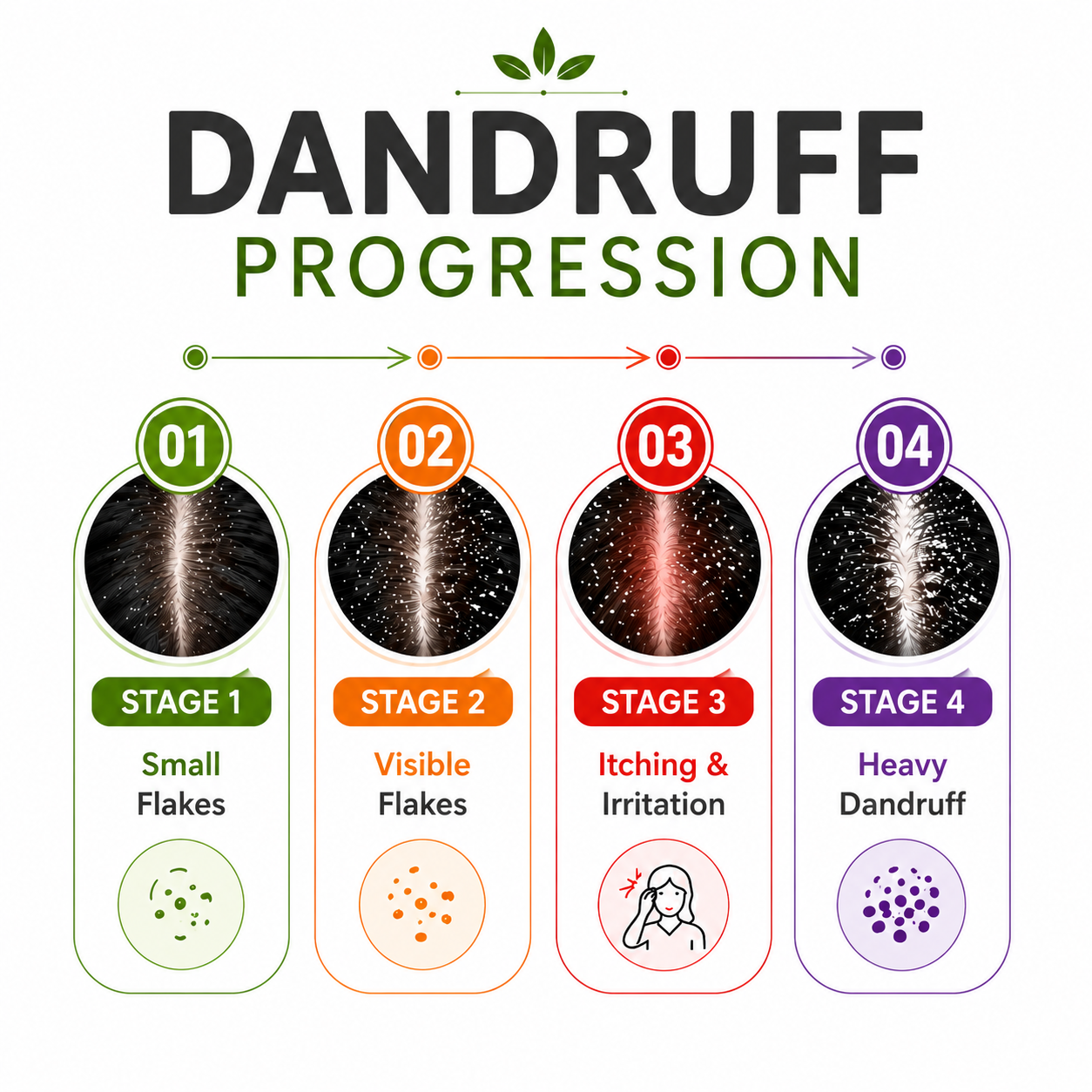Anti Dandruff Shampoo