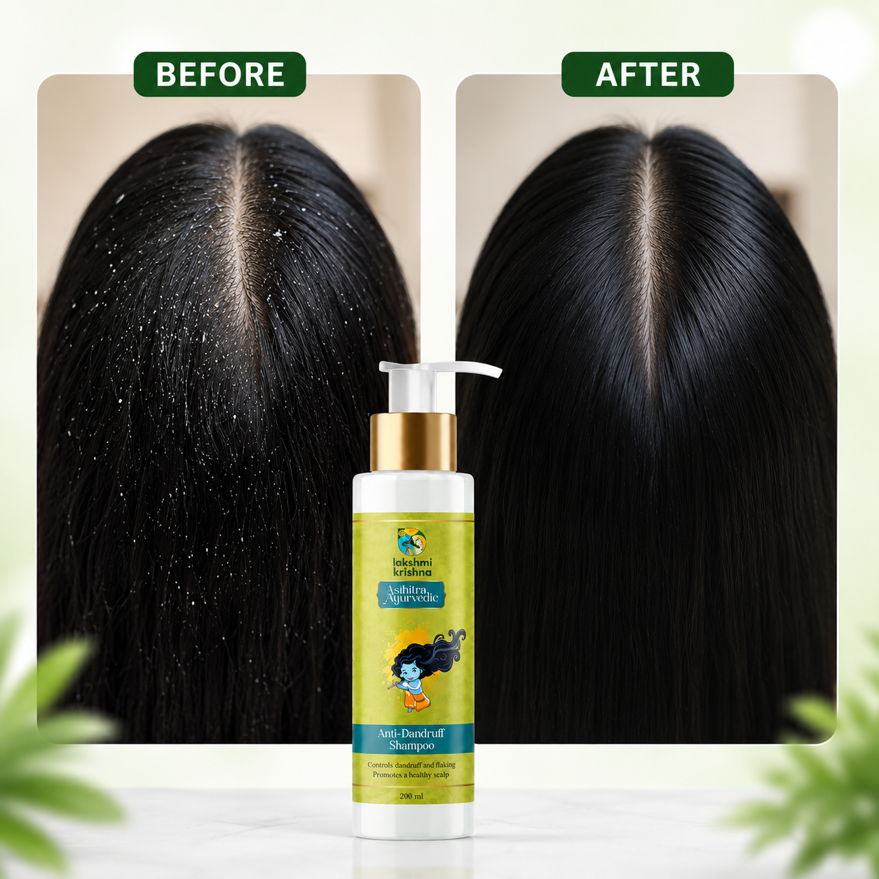 Anti Dandruff Shampoo
