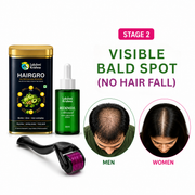 Hair Fall & Thinning Recovery Kit