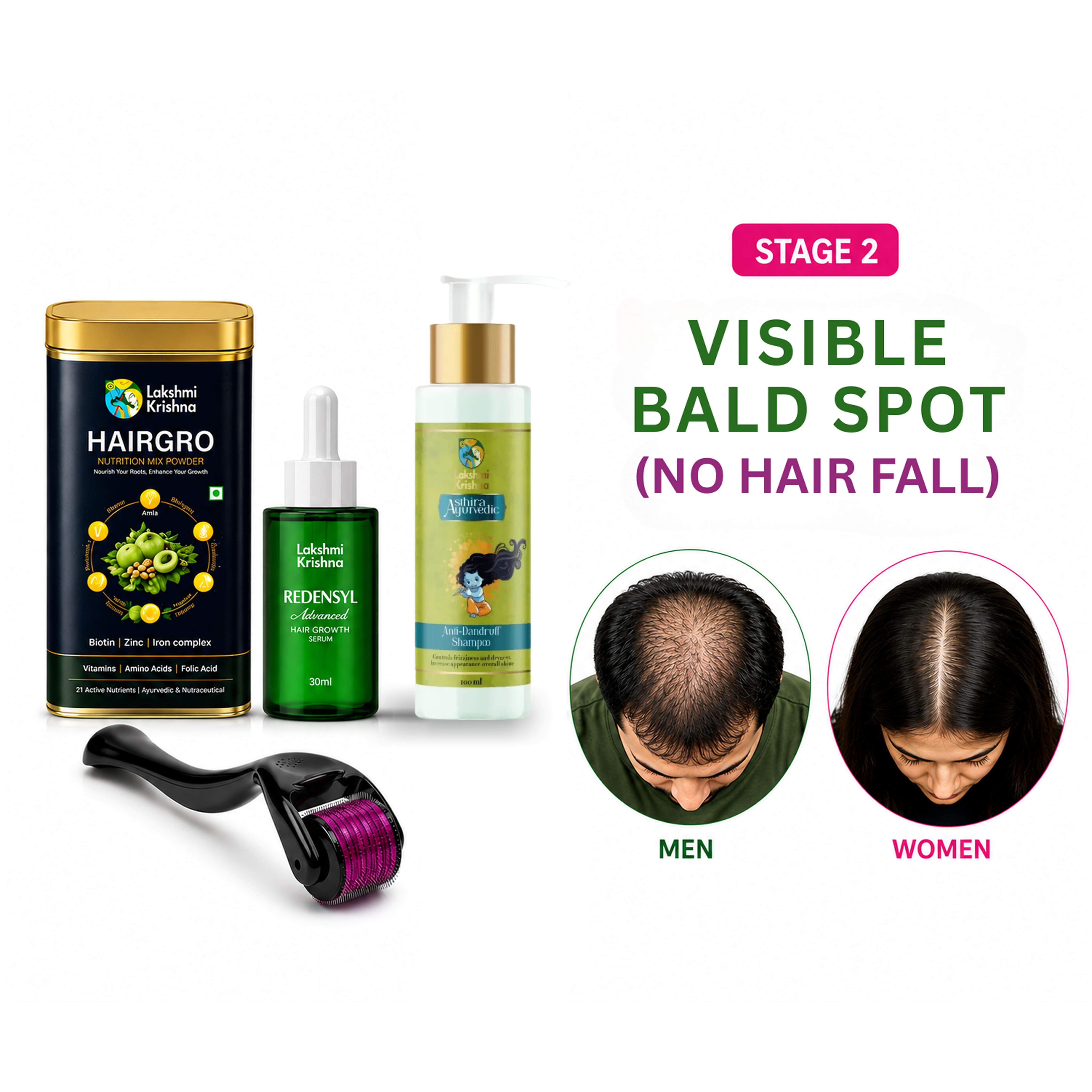 Hair Fall & Thinning Recovery Kit + Anti Dandruff Shampoo