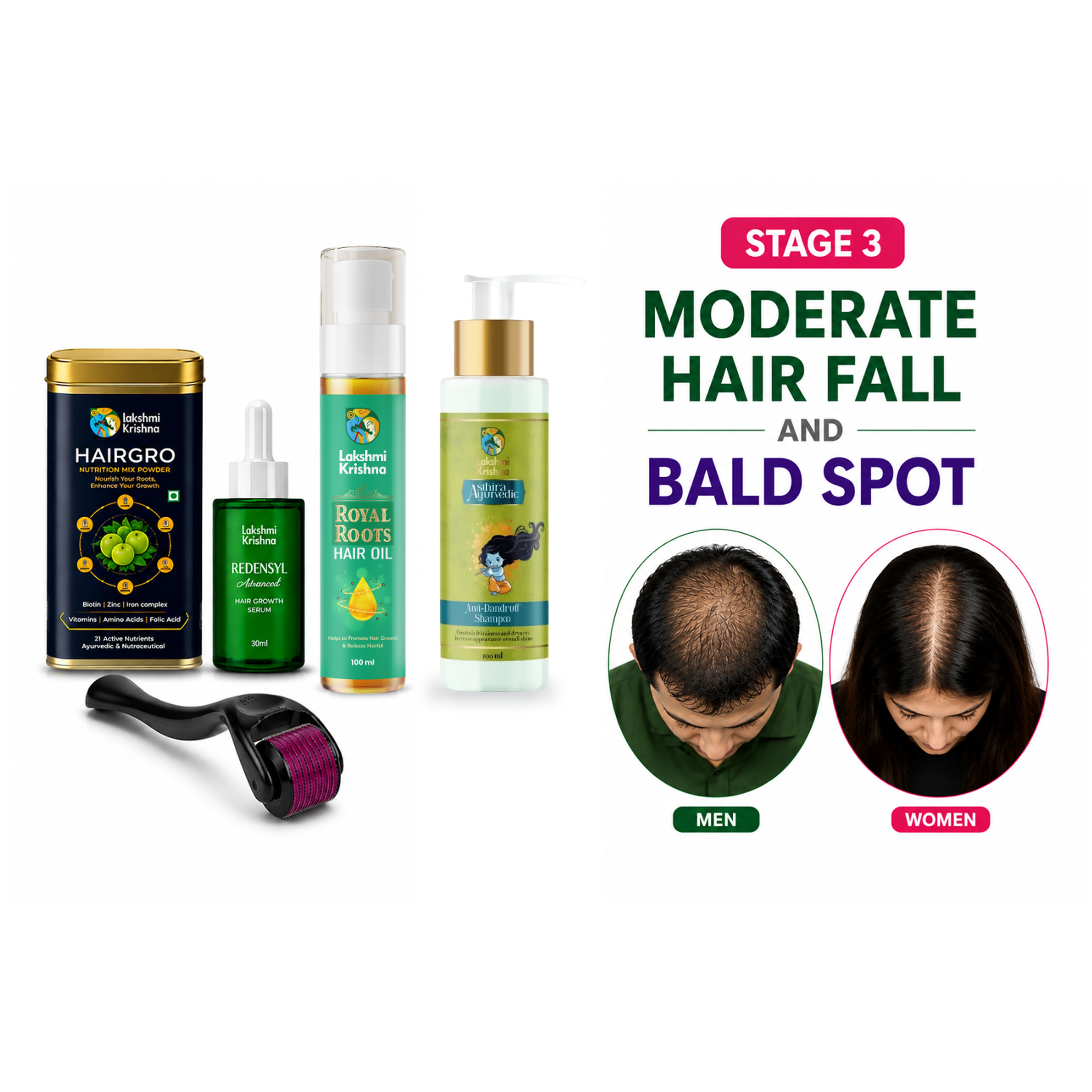 Bald Spot Recovery Kit + Anti Dandruff Shampoo