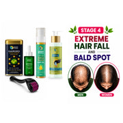 Extreme Hair Fall & Baldness Recovery Kit + Anti Dandruff Shampoo