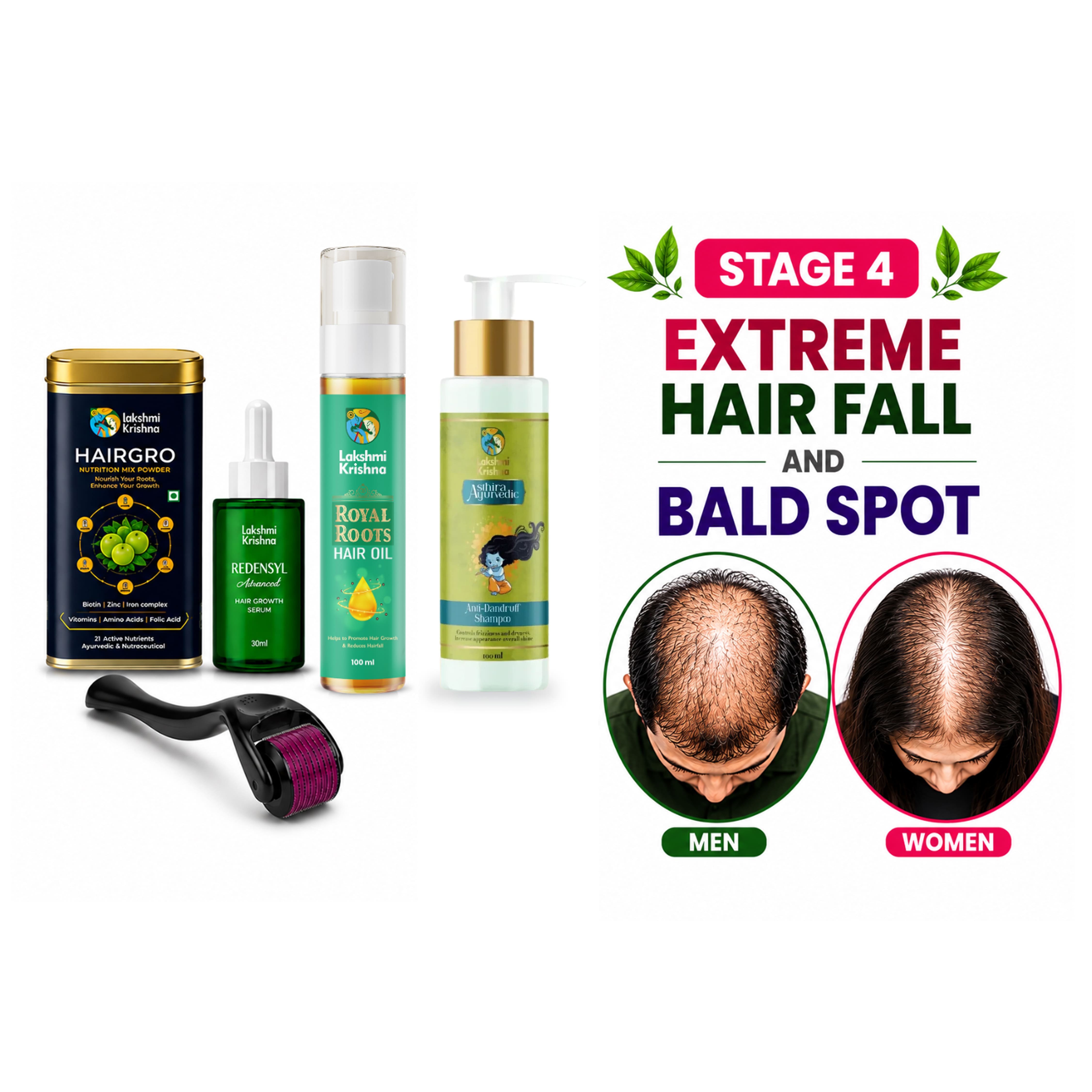 Extreme Hair Fall & Baldness Recovery Kit + Anti Dandruff Shampoo